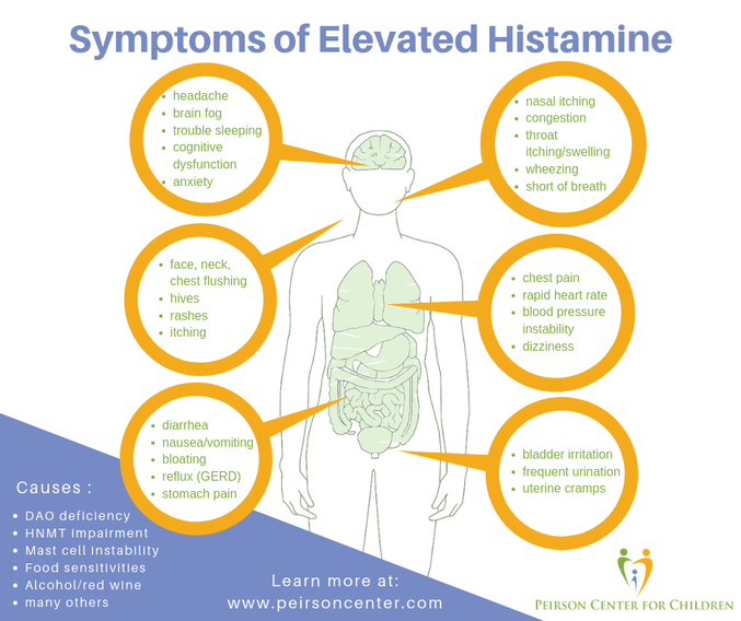 histamine allergy
